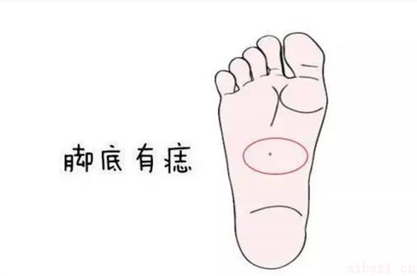 脚底有痣的女人命运怎样 女人脚底有痣有什么寓意