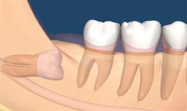 长智齿是否代表身体开始衰老 智齿长得早晚和寿命有关系吗